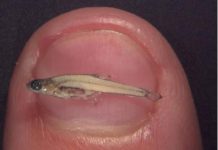 Fakta Unik, Ikan Terkecil di Dunia Hidup di Rawa Kalimantan